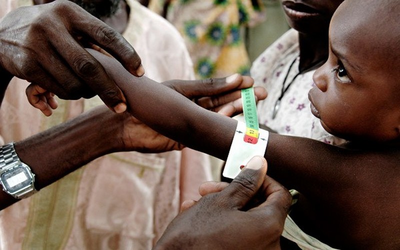 La malnutrition chronique rythme le quotidien des malgaches