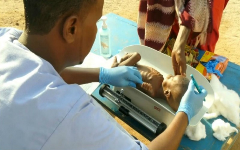 A cause de la sécheresse dans la Corne de l’Afrique, un bébé de 5 mois ne pèse que 3 kilos