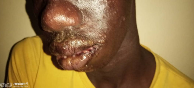 MALADIE MYSTERIEUSE AU SENEGAL : Ibrahima Kane, Dg Global Environnement: “ceci n’est pas nouveau en Afrique, c’est du poison versé…”