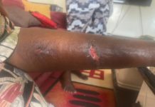 Parc Zoologique de Hann : Un singe attaque et « déchiquète » une visiteuse